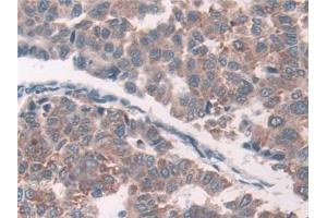 Immunohistochemistry (IHC) image for anti-Growth Factor Receptor-Bound Protein 10 (GRB10) (AA 392-594) antibody (ABIN7436048)