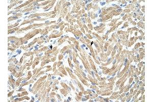 Tropomyosin 1 antibody was used for immunohistochemistry at a concentration of 4-8 ug/ml to stain Skeletal muscle cells (arrows) in Human Muscle. (Tropomyosin 抗体)