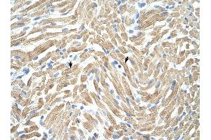 Tropomyosin 1 antibody was used for immunohistochemistry at a concentration of 4-8 ug/ml to stain Skeletal muscle cells (arrows) in Human Muscle.