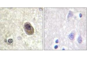 Immunohistochemistry analysis of paraffin-embedded human brain, using BAD (Phospho-Ser134) Antibody. (BAD 抗体  (pSer134))