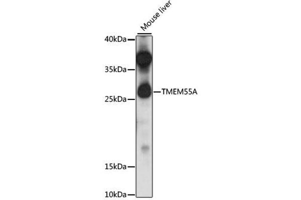TMEM55A Antikörper