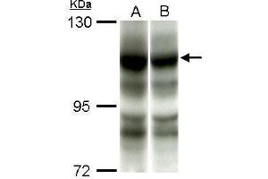 WB Image Sample (50 ug of whole cell lysate) A: C2C12 B: C2C12+AEA10mM antibody diluted at 1:1000