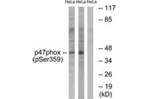 Western blot analysis of extracts from HeLa cells treated with nocodazole 1ug/ml 18h, using p47 phox (Phospho-Ser359) Antibody. (NCF1 抗体  (pSer359))