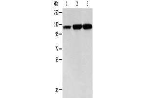 Western Blotting (WB) image for anti-Heat Shock 105kDa/110kDa Protein 1 (HSPH1) antibody (ABIN2421692) (HSPH1 抗体)