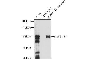 Immunoprecipitation analysis of 200 μg extracts of 293T cells, using 3 μg Phospho-p53-S15 pAb (ABIN3023600, ABIN3023601, ABIN3023602 and ABIN6225458). (p53 抗体  (pSer15))