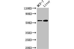 Western Blot Positive WB detected in: MCF-7 whole cell lysate, Mouse liver tissue All lanes: CBS antibody at 2. (CBS 抗体  (AA 1-413))