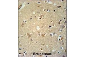 Immunohistochemistry (Paraffin-embedded Sections) (IHC (p)) image for anti-Purinergic Receptor P2X, Ligand-Gated Ion Channel, 7 (P2RX7) (AA 563-592) antibody (ABIN651861)