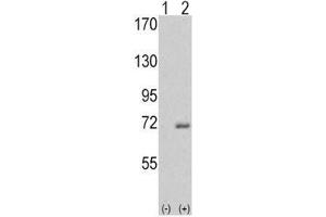Western blot analysis of IRAK antibody and 293 cell lysate either nontransfected (Lane 1) or transiently transfected with the IRAK1 gene (2). (IRAK1 抗体  (AA 683-712))