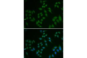 Immunofluorescence analysis of U2OS cells using TP63 antibody (ABIN5971164). (p63 抗体)