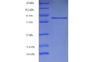 SDS-PAGE (SDS) image for gamma-aminobutyric Acid (GABA) A Receptor, alpha 4 (GABRA4) (AA 36-258) protein (His-SUMO Tag) (ABIN5709543) (GABRA4 Protein (AA 36-258) (His-SUMO Tag))