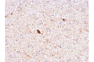 Formalin-fixed, paraffin-embedded human Brain stained with Serum Amyloid P Mouse Monoclonal Antibody (APCS/3240). (APCS 抗体  (AA 143-223))