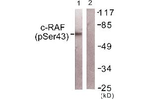 Western blot analysis of extracts from NIH/3T3cells, using c-RAF (Phospho-Ser43) antibody. (RAF1 抗体  (pSer43))