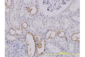 Immunostaining (ISt) image for anti-Solute Carrier Family 25 (Mitochondrial Carrier, Oxoglutarate Carrier), Member 11 (SLC25A11) (AA 1-314) antibody (ABIN563611)
