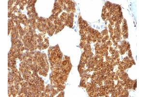 Formalin-fixed, paraffin-embedded human Parathyroid Gland stained with PTH Rabbit Polyclonal Antibody. (PTH 抗体  (AA 1-115))