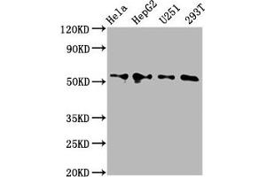 Western Blot Positive WB detected in: Hela whole cell lysate, HepG2 whole cell lysate, U251 whole cell lysate, 293T whole cell lysate All lanes: CCT6A antibody at 4. (CCT6A 抗体  (AA 80-250))