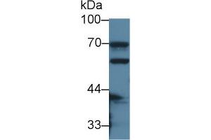 Western blot analysis of Mouse Small intestine lysate, using Mouse CES1 Antibody (2 µg/ml) and HRP-conjugated Goat Anti-Rabbit antibody ( (CES1 抗体  (AA 31-286))