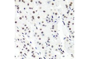 Immunohistochemistry of paraffin-embedded human stomach using HIST1H2BG antibody (ABIN6003628) at dilution of 1/100 (40x lens). (HIST1H2BG 抗体)