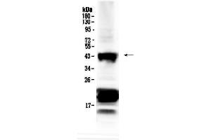 Western blot analysis of CHX10 using anti-CHX10 antibody . (VSX2 抗体  (AA 249-361))