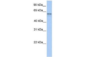 WB Suggested Anti-FAM13C1 Antibody Titration: 0. (FAM13C 抗体  (N-Term))