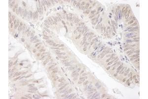 Immunohistochemistry (IHC) image for anti-Gem (Nuclear Organelle) Associated Protein 4 (GEMIN4) (C-Term) antibody (ABIN7448579) (GEMIN4 抗体  (C-Term))