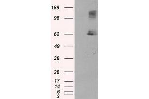 HEK293T cells were transfected with the pCMV6-ENTRY control (Left lane) or pCMV6-ENTRY LIPG (Right lane) cDNA for 48 hrs and lysed. (LIPG 抗体)
