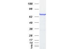 Validation with Western Blot