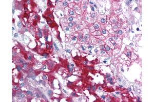 Anti-RPAIN antibody IHC of human adrenal. (RPAIN 抗体  (C-Term))