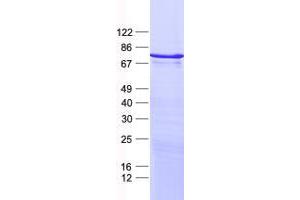 Western Blotting (WB) image for Zinc Finger Protein 449 (ZNF449) protein (His tag) (ABIN2736046)