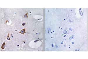 Immunohistochemistry analysis of paraffin-embedded human brain tissue, using CHSY1 antibody. (CHSY1 抗体  (Internal Region))