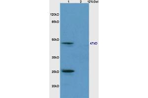 Lane 1: mouse brain lysates Lane 2: mouse embryo lysates probed with Anti phospho-Smad3 (Ser213) Polyclonal Antibody, Unconjugated (ABIN802383) at 1:200 in 4 °C. (SMAD3 抗体  (pSer213))