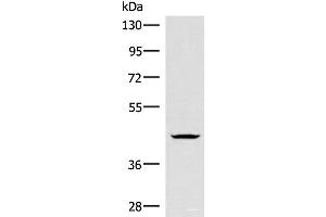 Western blot analysis of Jurkat cell lysate using HMBOX1 Polyclonal Antibody at dilution of 1:300 (HMBOX1 抗体)