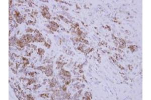 Image no. 1 for anti-DnaJ (Hsp40) Homolog, Subfamily A, Member 3 (DNAJA3) (AA 1-446) antibody (ABIN1497866)