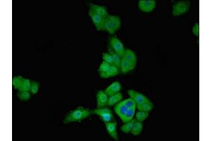 Immunofluorescent analysis of PC-3 cells using ABIN7171293 at dilution of 1:100 and Alexa Fluor 488-congugated AffiniPure Goat Anti-Rabbit IgG(H+L) (T-Box 1 抗体  (AA 22-107))