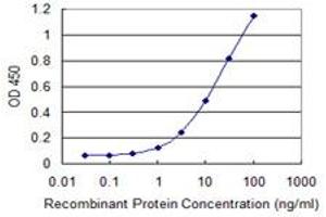 Detection limit for recombinant GST tagged PGM1 is 0. (Phosphoglucomutase 1 抗体  (AA 1-562))