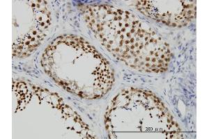 Immunoperoxidase of monoclonal antibody to KIF2 on formalin-fixed paraffin-embedded human testis. (KIF2A 抗体  (AA 1-679))