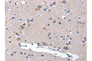 The image on the left is immunohistochemistry of paraffin-embedded Human brain tissue using ABIN7189813(ANP32C Antibody) at dilution 1/30, on the right is treated with synthetic peptide. (ANP32C 抗体)
