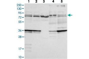 Western blot analysis of Lane 1: RT-4, Lane 2: U-251 MG, Lane 3: Human Plasma, Lane 4: Liver, Lane 5: Tonsil with KATNB1 polyclonal antibody  at 1:250-1:500 dilution. (KATNB1 抗体)