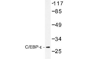 Image no. 1 for anti-CCAAT/enhancer Binding Protein (C/EBP), epsilon (CEBPE) antibody (ABIN272198) (CEBPE 抗体)