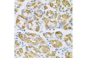 Immunohistochemistry of paraffin-embedded human stomach using SDC4 Antibody (ABIN5970935) at dilution of 1/100 (40x lens). (SDC4 抗体)
