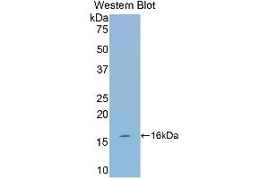 Western Blotting (WB) image for anti-Tryptase alpha/beta 1 (TPSAB1) (AA 149-273) antibody (ABIN1174174) (TPSAB1 抗体  (AA 149-273))