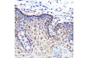 Immunohistochemistry of paraffin-embedded human esophageal using  Rabbit mAb (ABIN7265589) at dilution of 1:100 (40x lens). (Angiopoietin 2 抗体)
