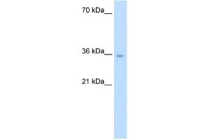 ATIC antibody - middle region  validated by WB using Jurkat cell lysate at 5. (ATIC 抗体  (Middle Region))