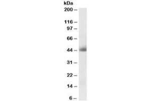 Western blot testing of human kidney lysate with CA12 antibody at 0. (CA12 抗体)