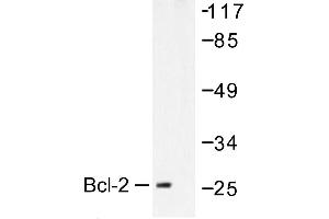 Image no. 1 for anti-B-Cell CLL/lymphoma 2 (BCL2) antibody (ABIN271996) (Bcl-2 抗体)