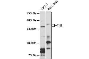 Western blot analysis of extracts of various cell lines, using TIE1 antibody (ABIN1683033, ABIN3017717, ABIN3017718 and ABIN6220214) at 1:1000 dilution. (TIE1 抗体  (AA 350-600))