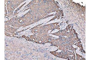 IHC analysis of GNAL using anti-GNAL antibody (ABIN7599757).