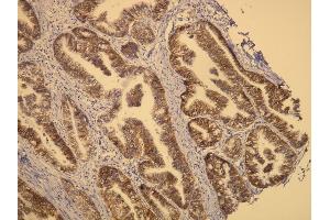Immunohistochemistry (IHC) image for anti-Receptor tyrosine-protein kinase erbB-2 (ErbB2/Her2) (C-Term) antibody (ABIN870539) (ErbB2/Her2 抗体  (C-Term))