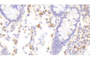 Immunohistochemistry (IHC) image for anti-Signal Transducer and Activator of Transcription 1, 91kDa (STAT1) (AA 343-602) antibody (ABIN7443806)