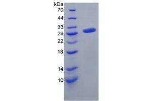 Fibroblast Growth Factor 23 (FGF23) (AA 25-251) (Active) protein (His tag)