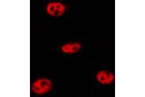 Immunofluorescence (fixed cells) (IF/ICC) image for anti-Tumor Protein P53 (TP53) (pSer9) antibody (ABIN6255556)